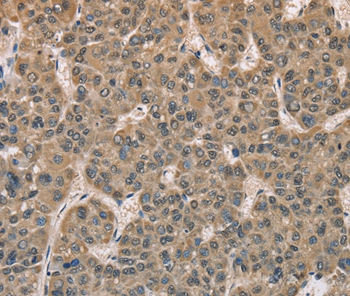 DACH2 Antibody