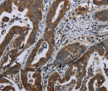 BRINP1 Antibody - SAB | Signalway Antibody