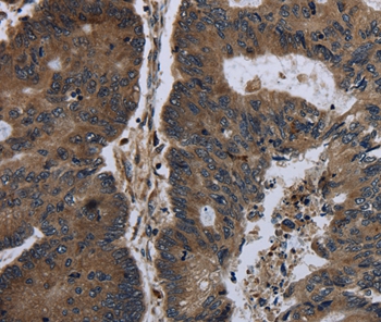 BRINP1 Antibody