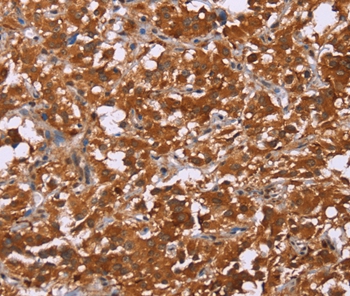 DCBLD2 Antibody