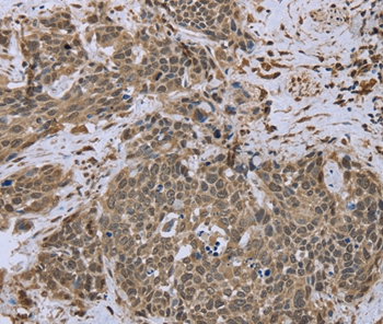 DCTN4 Antibody