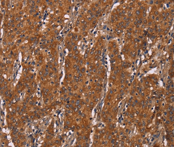 DCTN6 Antibody