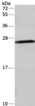 DCTN6 Antibody