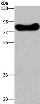 DDX43 Antibody