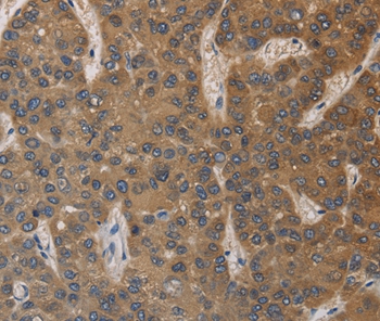 DEGS1 Antibody