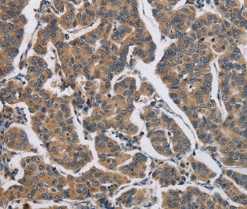 DHRS3 Antibody