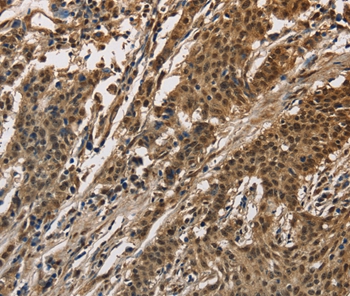 CCAR1 Antibody