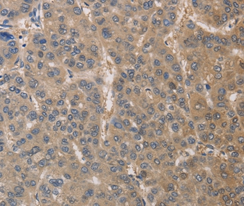 DPYSL3 Antibody