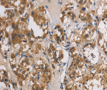 DUSP26 Antibody