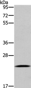 UBE2S Antibody