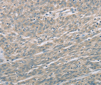 EDA2R Antibody