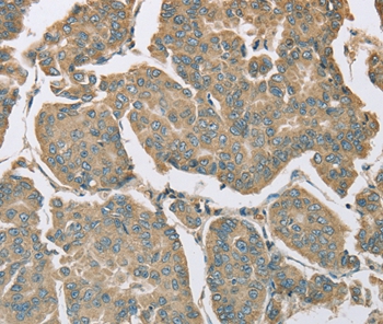 EIF5 Antibody