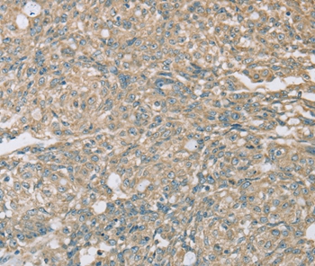 EIF5 Antibody