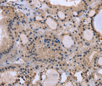 KIAA1324 Antibody