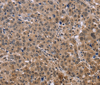 KIF25 Antibody