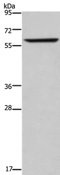 ENTPD5 Antibody