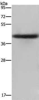 EPSTI1 Antibody