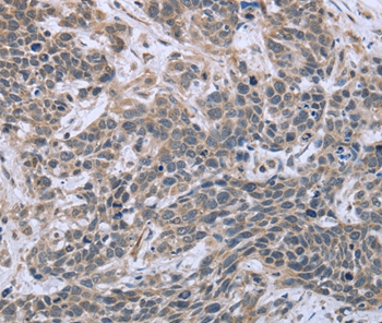 ESR2 Antibody