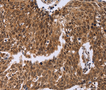 ERCC6L Antibody