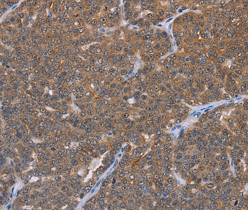 FABP6 Antibody