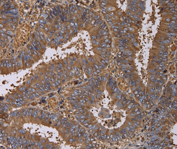 FADS1 Antibody