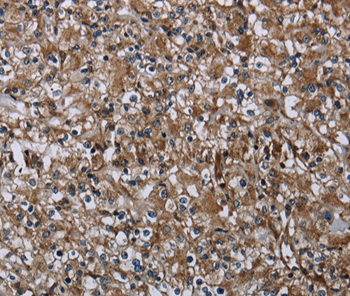 FAM89B Antibody