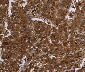 FASTKD1 Antibody