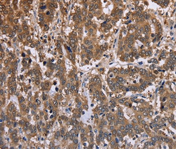 FBP2 Antibody