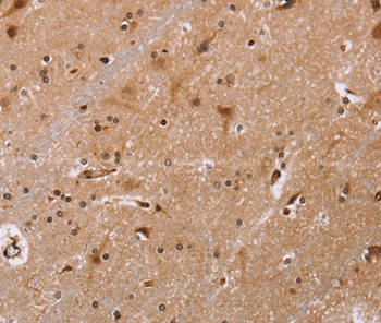 FBP2 Antibody