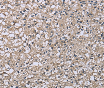 FCGR2B Antibody