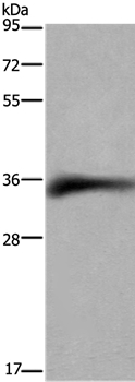 FCGR2B Antibody