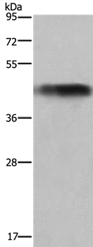 GALT Antibody