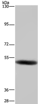 GABRB1 Antibody