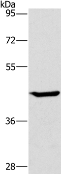 GCK Antibody