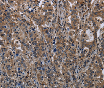 TSC22D3 Antibody