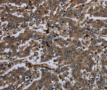 GP1BA Antibody