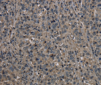 GSTO1 Antibody