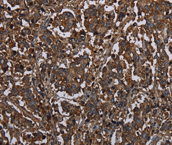 HACL1 Antibody