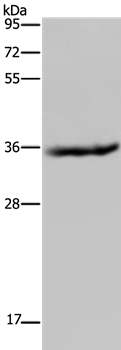 HSD17B6 Antibody