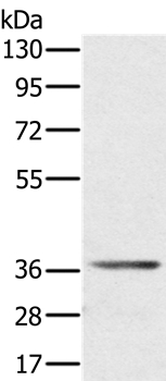 AKR1C4 Antibody