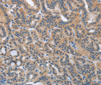 HSD3B1 Antibody