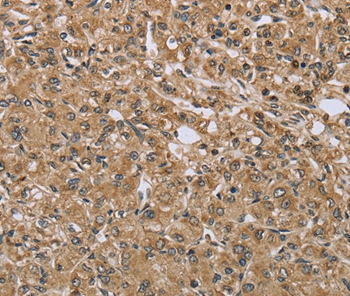 TXLNA Antibody