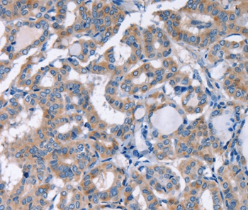 KCNQ5 Antibody