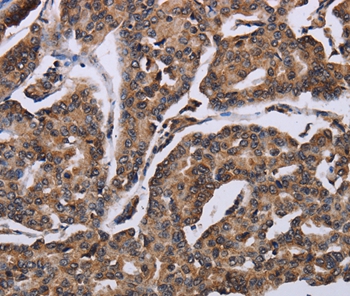 KIF1C Antibody