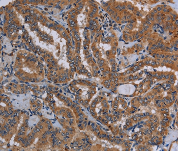 KLK13 Antibody