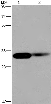 LIMS1 Antibody