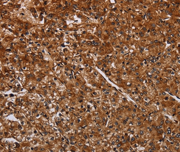 ACP6 Antibody