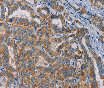 TAB3 Antibody