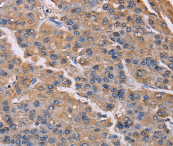 PMAIP1 Antibody