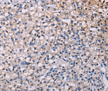 PMAIP1 Antibody